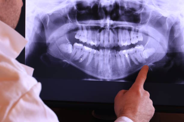 Best Emergency Treatment for Dental Infections or Abscesses in Belmar, NJ
