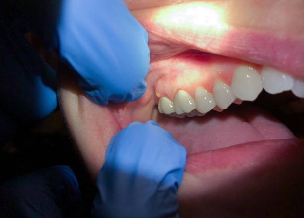 Best Emergency TMJ Treatment in Belmar, NJ